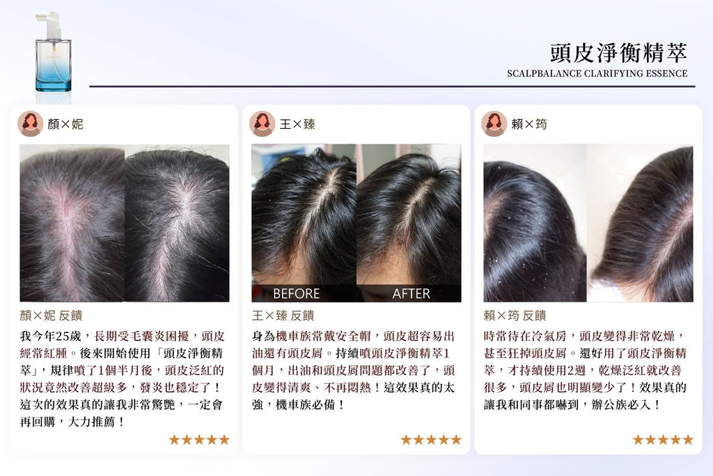 台灣鉑菲 Perfect Skin 頭皮淨衡精萃 50ml
