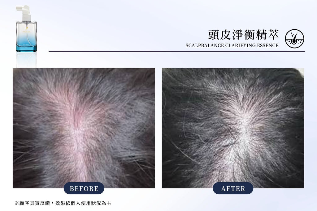 台灣鉑菲 Perfect Skin 頭皮淨衡精萃 50ml