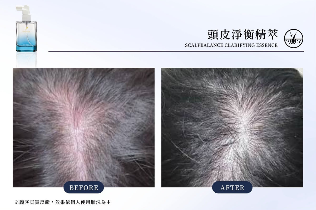 台灣鉑菲 Perfect Skin 頭皮淨衡精萃 50ml