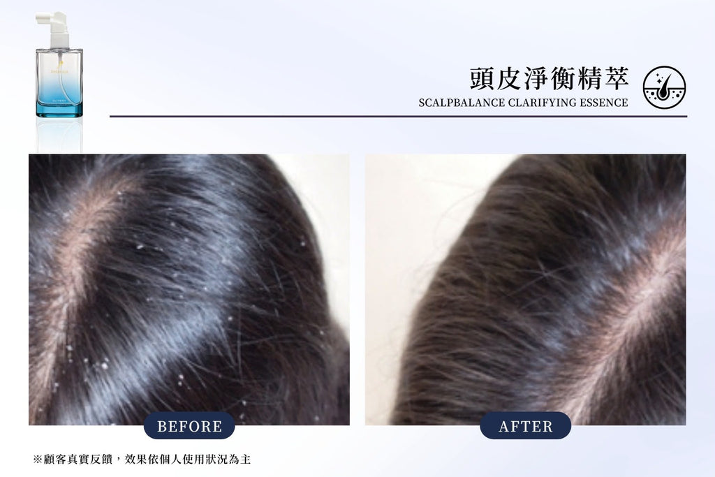 台灣鉑菲 Perfect Skin 頭皮淨衡精萃 50ml